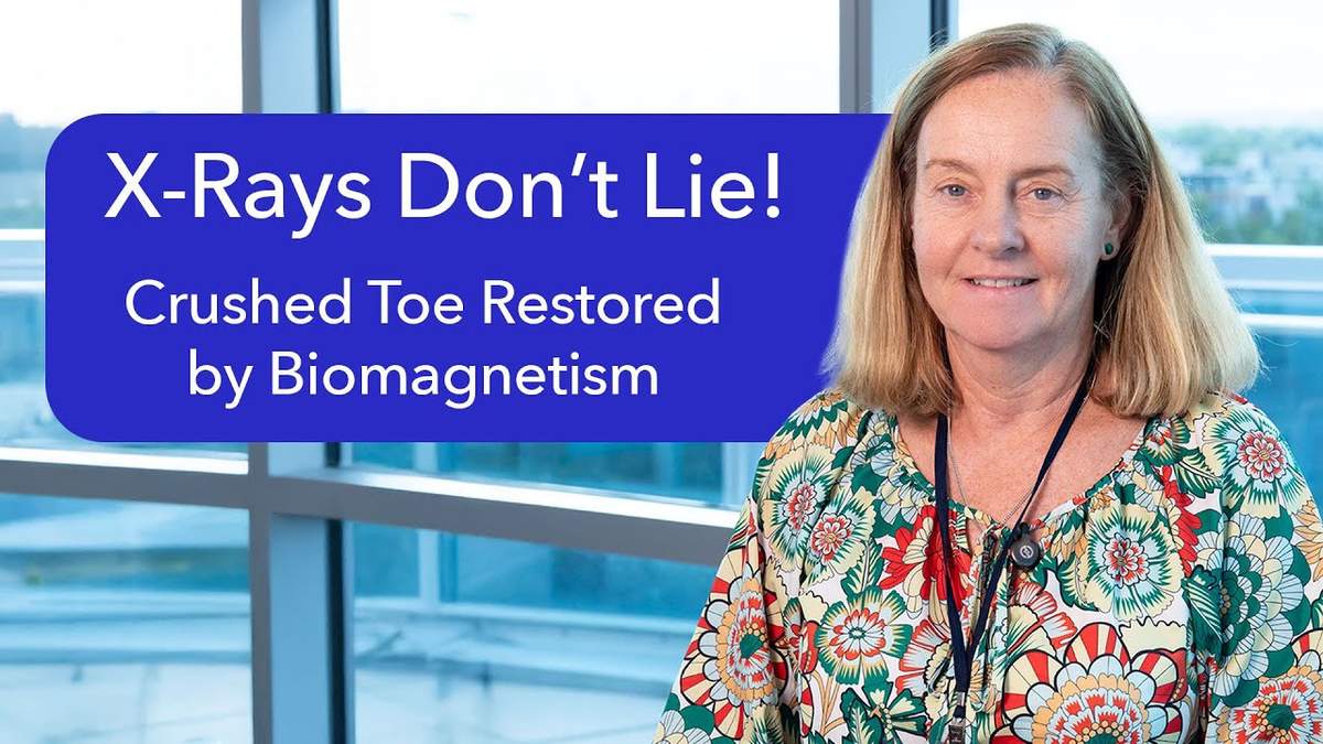 X-Rays Don’t Lie: Broken Toe Restored Naturally with Biomagnetism